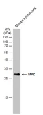Anti-MPZ antibody used in Western Blot (WB). GTX134070