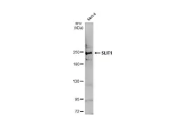 Anti-SLIT1 antibody used in Western Blot (WB). GTX134122