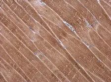 Anti-Desmuslin antibody used in IHC (Paraffin sections) (IHC-P). GTX134124
