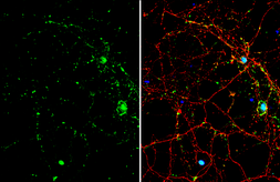 Anti-SMAD7 antibody used in Immunocytochemistry/ Immunofluorescence (ICC/IF). GTX134232