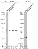 Anti-PKC eta antibody used in Western Blot (WB). GTX134256