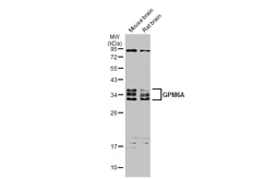 Anti-GPM6A antibody used in Western Blot (WB). GTX134740