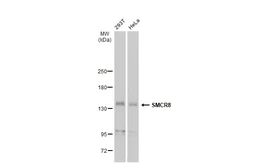 Anti-SMCR8 antibody used in Western Blot (WB). GTX134785
