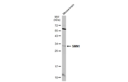 Anti-SMN1 antibody used in Western Blot (WB). GTX134791