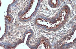 Anti-B-Raf antibody used in IHC (Paraffin sections) (IHC-P). GTX134824