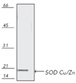 Anti-SOD1 antibody used in Western Blot (WB). GTX13499