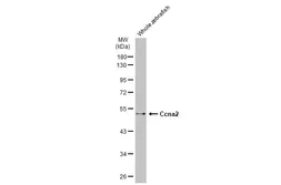 Anti-Ccna2 antibody used in Western Blot (WB). GTX135147