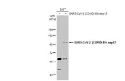 Anti-SARS-CoV-2 (COVID-19) nsp12 antibody used in Western Blot (WB). GTX135467