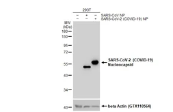 Anti-SARS-CoV-2 (COVID-19) Nucleocapsid antibody used in Western Blot (WB). GTX135570