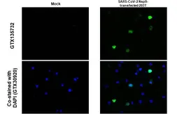 Anti-SARS-CoV-2 (COVID-19) nsp9 antibody used in IHC-P (cell pellet) (IHC-P (cell pellet)). GTX135732