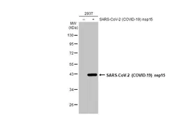 Anti-SARS-CoV-2 (COVID-19) nsp15 antibody used in Western Blot (WB). GTX135737