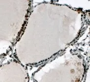 Anti-ELF5 antibody, C-term used in IHC (Paraffin sections) (IHC-P). GTX13581