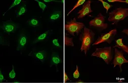 Anti-hnRNP G antibody used in Immunocytochemistry/ Immunofluorescence (ICC/IF). GTX135993