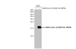Anti-SARS-CoV-2 (COVID-19) ORF9b antibody used in Western Blot (WB). GTX136053