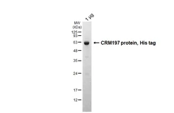 CRM197 protein, His tag. GTX136284-pro