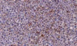 Anti-Noxa antibody [114C307.1] used in IHC (Paraffin sections) (IHC-P). GTX13654