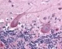 Anti-TEM7 antibody [197C193(IM193)] used in IHC (Paraffin sections) (IHC-P). GTX13667