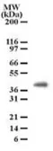 Anti-PGRP1B antibody [186C426] used in Western Blot (WB). GTX13681