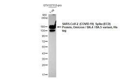 SARS-CoV-2 (COVID-19) Spike (ECD) Protein, Omicron / BA.4 / BA.5 variant, His tag. GTX137113-pro