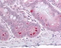 Anti-SETD7 antibody used in IHC (Paraffin sections) (IHC-P). GTX13731