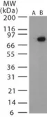 Anti-Bacillus anthracis protective antigen antibody used in Western Blot (WB). GTX13809
