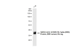 SARS-CoV-2 (COVID-19) Spike RBD Protein, Omicron / XBB variant, His tag. GTX138115-pro