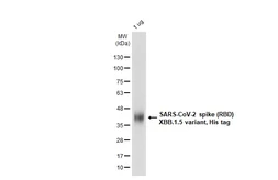 SARS-CoV-2 (COVID-19) Spike RBD Protein, Omicron / XBB.1.5 variant, His tag. GTX138287-pro