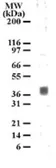 Anti-5-HT1B receptor antibody used in Western Blot (WB). GTX13896