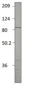 Anti-PDE2A antibody used in Western Blot (WB). GTX14605