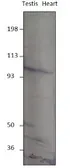 Anti-PDE8B antibody used in Western Blot (WB). GTX14621