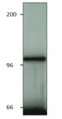 Anti-ACK1 antibody used in Immunoprecipitation (IP). GTX14776