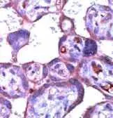 Anti-c-Abl antibody used in IHC (Paraffin sections) (IHC-P). GTX15130