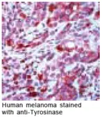 Anti-Tyrosinase antibody used in Immunohistochemistry (IHC). GTX15175