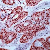 Anti-Retinoid X Receptor gamma antibody used in IHC (Paraffin sections) (IHC-P). GTX15518