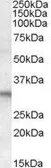 Anti-FHL2 antibody, C-term used in Western Blot (WB). GTX15715