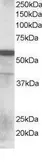 Anti-RNF8 antibody, N-term used in Western Blot (WB). GTX15850