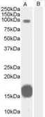 Anti-GRAF antibody, C-term used in Western Blot (WB). GTX15916