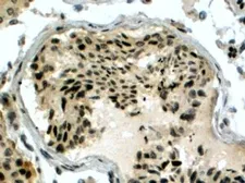 Anti-RAD51AP1 antibody, C-term used in IHC (Paraffin sections) (IHC-P). GTX15957