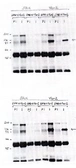 Anti-VAV2 antibody used in Western Blot (WB). GTX16135