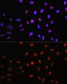 Anti-TCF4 antibody used in Immunocytochemistry/ Immunofluorescence (ICC/IF). GTX16385