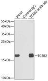 Anti-Elongin B antibody used in Immunoprecipitation (IP). GTX16427