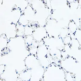 Anti-GAS41 antibody used in IHC (Paraffin sections) (IHC-P). GTX16452