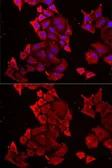 Anti-TIM17 antibody used in Immunocytochemistry/ Immunofluorescence (ICC/IF). GTX16468