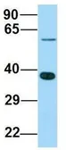 Anti-ABHD17A antibody, C-term used in Western Blot (WB). GTX16552
