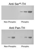Anti-Tyrosine Hydroxylase (phospho Ser40) antibody used in Western Blot (WB). GTX16557