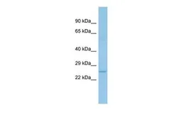Anti-ACOT6 antibody, C-term used in Western Blot (WB). GTX16558