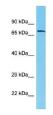 Anti-ACOX2 antibody, C-term used in Western Blot (WB). GTX16571