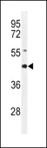 Anti-RAGE antibody used in Western Blot (WB). GTX16592