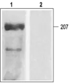 Anti-Cav1.2 antibody used in Western Blot (WB). GTX16606