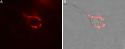 Anti-CACNA2D1 antibody used in Live cell imaging (LCI). GTX16607